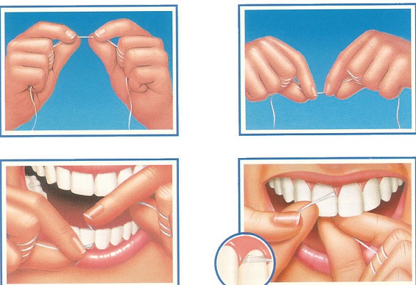 Tác dụng của chỉ nha khoa